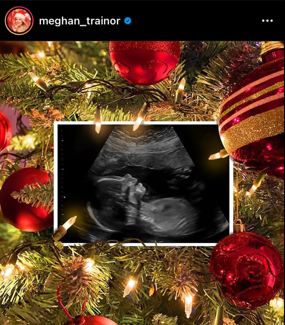 The Hypocrisy Of Pro choice Beliefs Appforlife